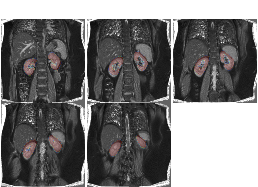 plot 3d multislice translation t1