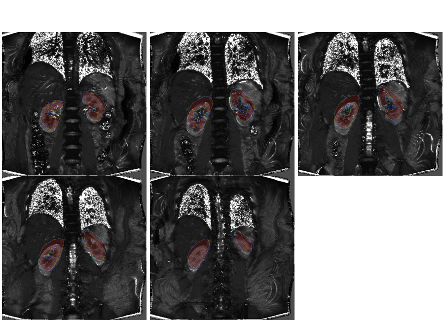 plot 3d multislice translation t2